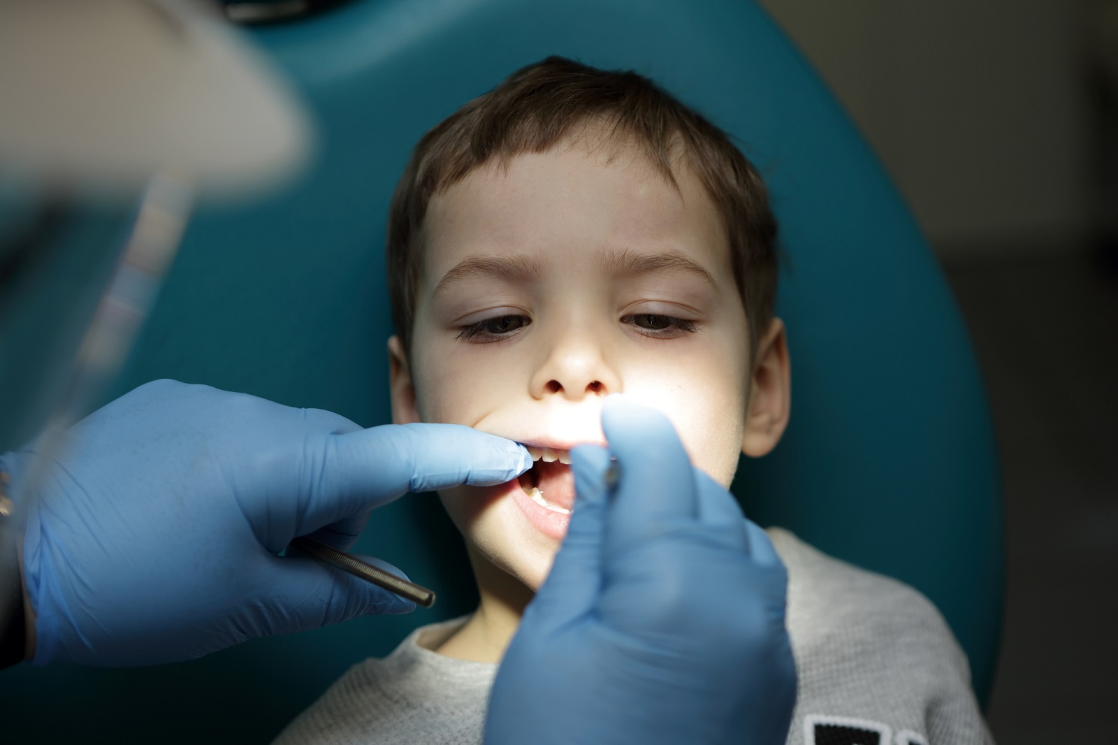 Inspection of the child's teeth